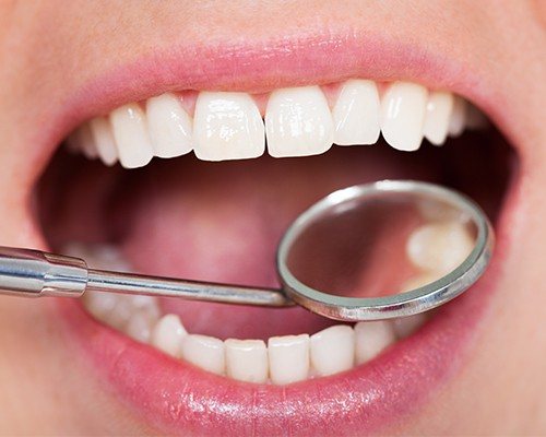 Closeup of healthy smile