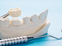 A closeup of a single dental crown next a mock jaw model and dental tools