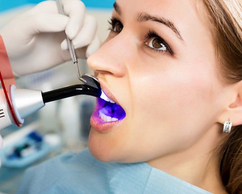 woman getting tooth-colored filling hardened with curing light 