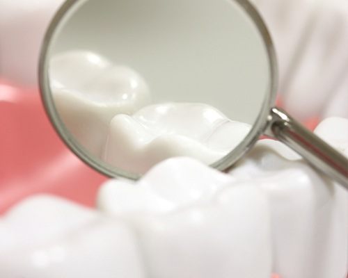 Closeup of smile during dental exam