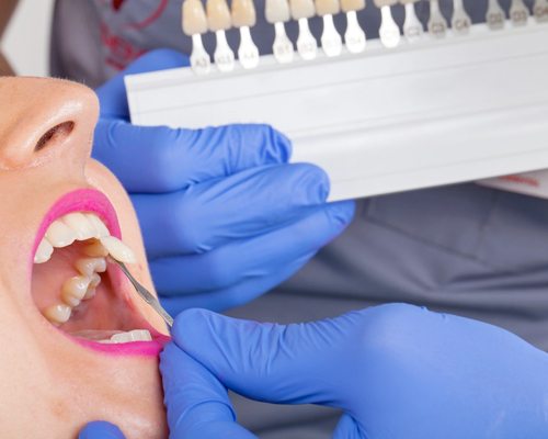 dentist matching the color of a patient’s teeth
