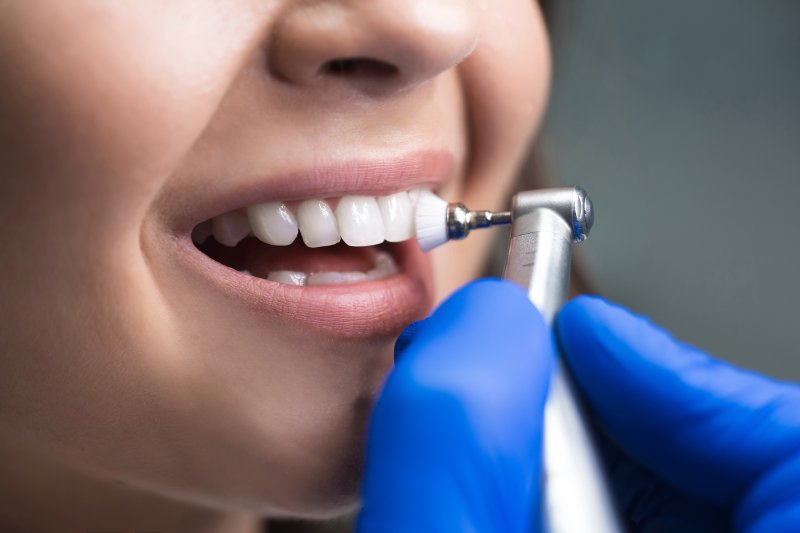 Dentist in Center cleaning teeth