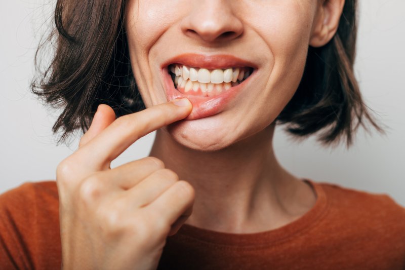 Lady shows gums